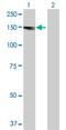 Alsin Rho Guanine Nucleotide Exchange Factor ALS2 antibody, H00057679-D01P, Novus Biologicals, Western Blot image 