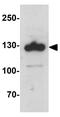 Sterol regulatory element-binding protein 2 antibody, GTX31580, GeneTex, Western Blot image 