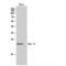 RAB31, Member RAS Oncogene Family antibody, LS-C385699, Lifespan Biosciences, Western Blot image 