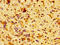 Chaperonin Containing TCP1 Subunit 7 antibody, CSB-PA859112LA01HU, Cusabio, Immunohistochemistry paraffin image 