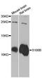 S100 Calcium Binding Protein B antibody, MBS126771, MyBioSource, Western Blot image 