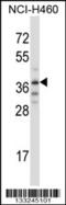 E3 ubiquitin-protein ligase TRIM31 antibody, 57-173, ProSci, Western Blot image 