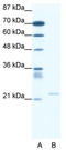Transient Receptor Potential Cation Channel Subfamily M Member 3 antibody, TA341729, Origene, Western Blot image 