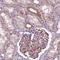 Outer Dense Fiber Of Sperm Tails 3 Like 2 antibody, HPA067973, Atlas Antibodies, Immunohistochemistry paraffin image 