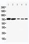 Solute Carrier Family 5 Member 1 antibody, PA2244, Boster Biological Technology, Western Blot image 