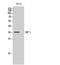 Interferon Regulatory Factor 1 antibody, STJ97352, St John