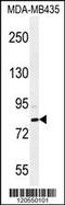 SET And MYND Domain Containing 4 antibody, 55-927, ProSci, Western Blot image 