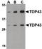 TAR DNA Binding Protein antibody, PA5-20408, Invitrogen Antibodies, Western Blot image 