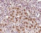 5'-3' Exoribonuclease 2 antibody, GTX01072, GeneTex, Immunohistochemistry paraffin image 