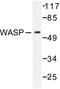 WASP antibody, LS-C176481, Lifespan Biosciences, Western Blot image 