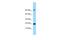 Adenosine Deaminase TRNA Specific 2 antibody, A13324, Boster Biological Technology, Western Blot image 