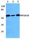 Protein Phosphatase 2 Scaffold Subunit Abeta antibody, PA5-37019, Invitrogen Antibodies, Western Blot image 