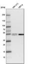 Ligand Dependent Nuclear Receptor Corepressor antibody, HPA031428, Atlas Antibodies, Western Blot image 