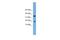 Acid Phosphatase antibody, NBP1-55482, Novus Biologicals, Western Blot image 