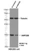 Acidic Nuclear Phosphoprotein 32 Family Member B antibody, 66160-1-Ig, Proteintech Group, Western Blot image 