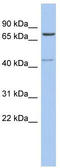 Peroxisomal Biogenesis Factor 5 antibody, TA335145, Origene, Western Blot image 