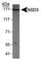 Histone-lysine N-methyltransferase NSD3 antibody, TA309929, Origene, Western Blot image 