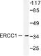 ERCC Excision Repair 1, Endonuclease Non-Catalytic Subunit antibody, LS-C176009, Lifespan Biosciences, Western Blot image 