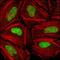 Checkpoint Kinase 2 antibody, GTX83198, GeneTex, Immunofluorescence image 