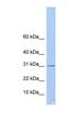 Ethylmalonyl-CoA Decarboxylase 1 antibody, NBP1-53053, Novus Biologicals, Western Blot image 