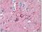 Tubulin Alpha 1b antibody, SM568P, Origene, Immunohistochemistry paraffin image 