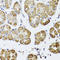 Histone Deacetylase 6 antibody, STJ113792, St John