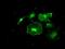 Fyn Related Src Family Tyrosine Kinase antibody, GTX84481, GeneTex, Immunocytochemistry image 