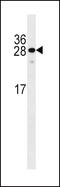 Kruppel Like Factor 9 antibody, 58-354, ProSci, Western Blot image 