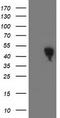 Spermine Synthase antibody, TA503091, Origene, Western Blot image 