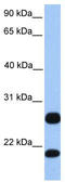 Arginine And Serine Rich Protein 1 antibody, TA346632, Origene, Western Blot image 
