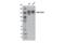 ATP Binding Cassette Subfamily B Member 1 antibody, 12683S, Cell Signaling Technology, Western Blot image 