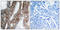 Integrin Subunit Beta 3 antibody, LS-C118150, Lifespan Biosciences, Immunohistochemistry frozen image 
