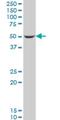 VH3 antibody, H00001847-M05, Novus Biologicals, Western Blot image 