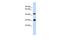 Cilia And Flagella Associated Protein 299 antibody, GTX45258, GeneTex, Western Blot image 