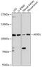 AP-3 complex subunit delta-1 antibody, 14-770, ProSci, Western Blot image 