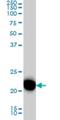 RAS Related antibody, H00006237-M01, Novus Biologicals, Western Blot image 