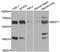 Bestrophin 1 antibody, A5735, ABclonal Technology, Western Blot image 