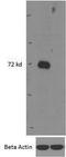 Interleukin 1 Receptor Associated Kinase 3 antibody, GTX88632, GeneTex, Western Blot image 