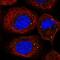 PAT1 Homolog 1, Processing Body MRNA Decay Factor antibody, HPA039030, Atlas Antibodies, Immunofluorescence image 