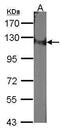 Damage Specific DNA Binding Protein 1 antibody, PA5-21282, Invitrogen Antibodies, Western Blot image 