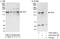 Abelson Helper Integration Site 1 antibody, A303-301A, Bethyl Labs, Western Blot image 