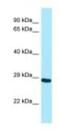Nei Like DNA Glycosylase 2 antibody, NBP1-98526, Novus Biologicals, Western Blot image 