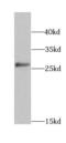 15-Hydroxyprostaglandin Dehydrogenase antibody, FNab03995, FineTest, Western Blot image 