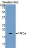 ADAM Metallopeptidase With Thrombospondin Type 1 Motif 1 antibody, LS-C298522, Lifespan Biosciences, Western Blot image 