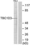 TBC1 Domain Family Member 3B antibody, TA316467, Origene, Western Blot image 