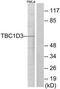 TBC1 Domain Family Member 3B antibody, TA316467, Origene, Western Blot image 