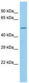 Hair keratin, type I Ha1 antibody, TA332129, Origene, Western Blot image 