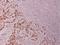 BCL2 antibody, A00040T56, Boster Biological Technology, Immunohistochemistry frozen image 