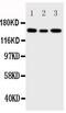Insulin Like Growth Factor 1 Receptor antibody, PA5-79444, Invitrogen Antibodies, Western Blot image 
