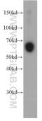 Serpin Family A Member 3 antibody, 66078-1-Ig, Proteintech Group, Western Blot image 